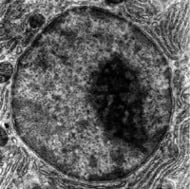 A figura representa uma imagem de um núcleo, obtida por microscopia eletrônica, tendo o nucléolo evidenciado por sua coloração escura.